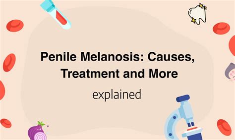 Penile melanosis: Causes, treatment, and more